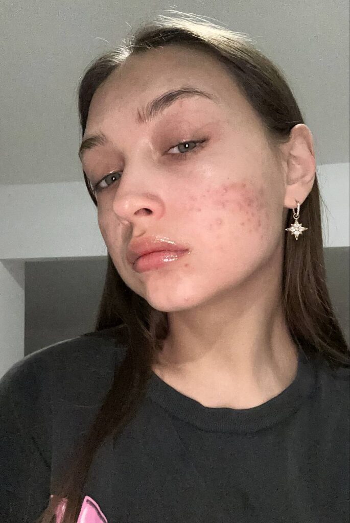 Слив Ностя (Nostyanka) OnlyFans слив фото 9 Блогерши 2026